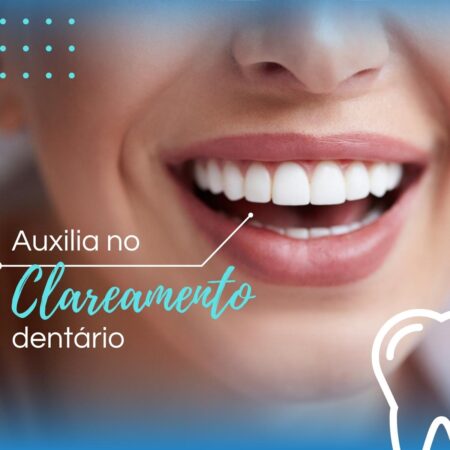 sorriso-forever-gel-dental
